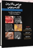 جراحی بالا بردن کف سینوس